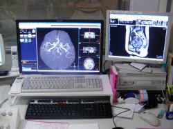 MRI1