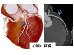 心臓CT画像