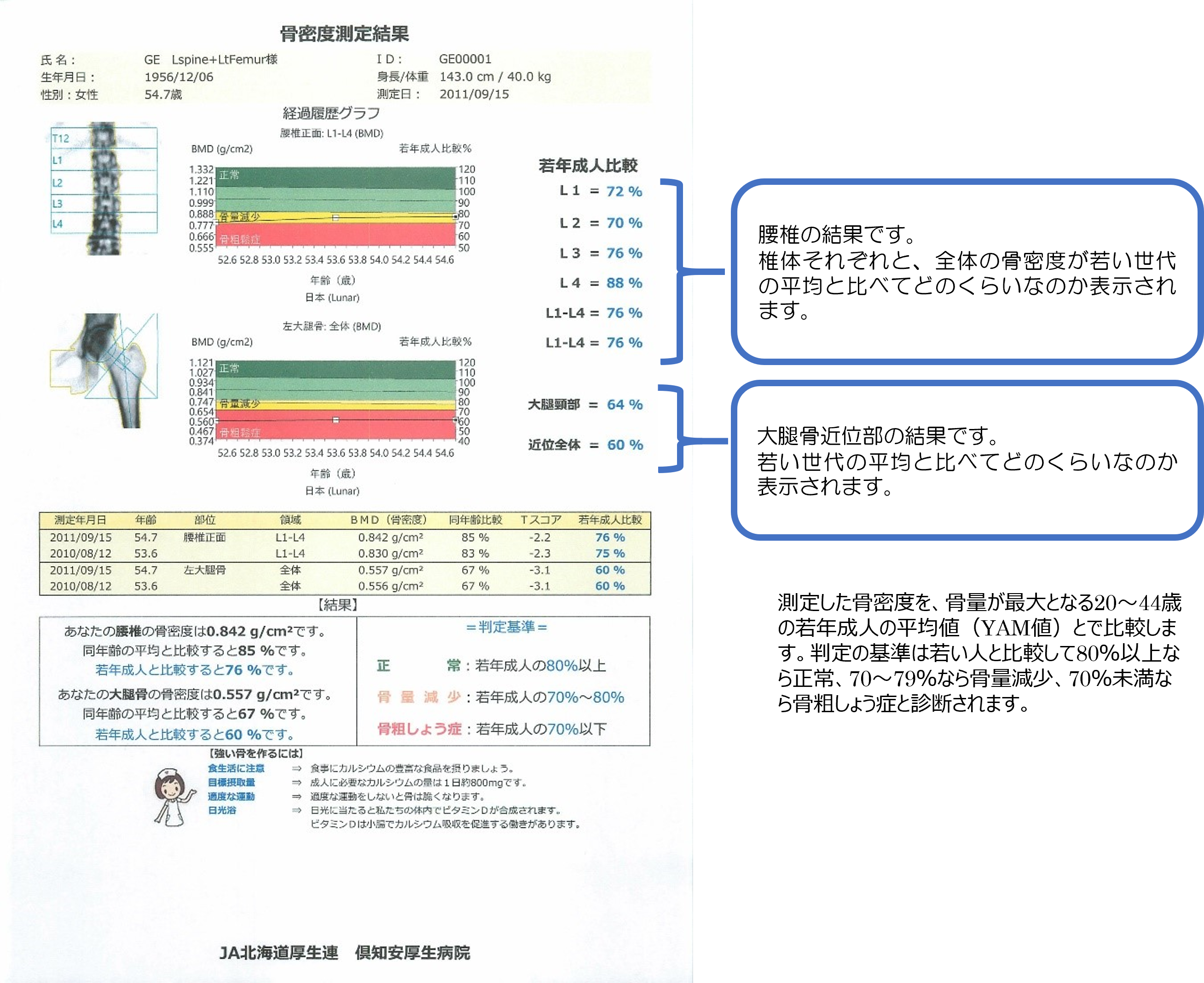 DXA結果