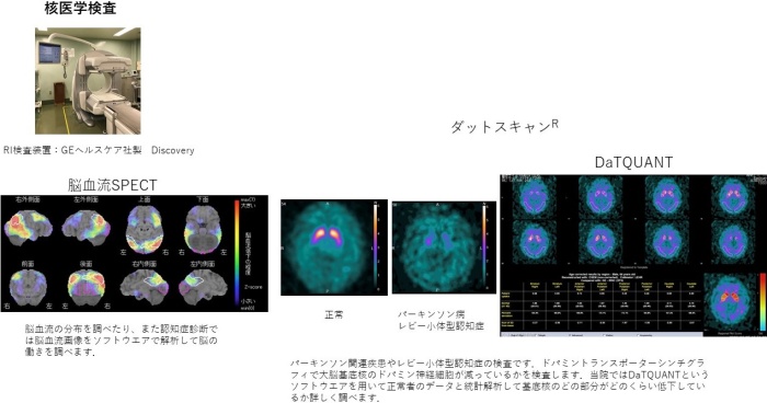 核医学検査