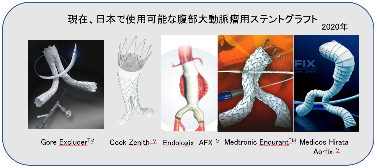 日本で使用可能な腹部大動脈瘤用ステントグラフト