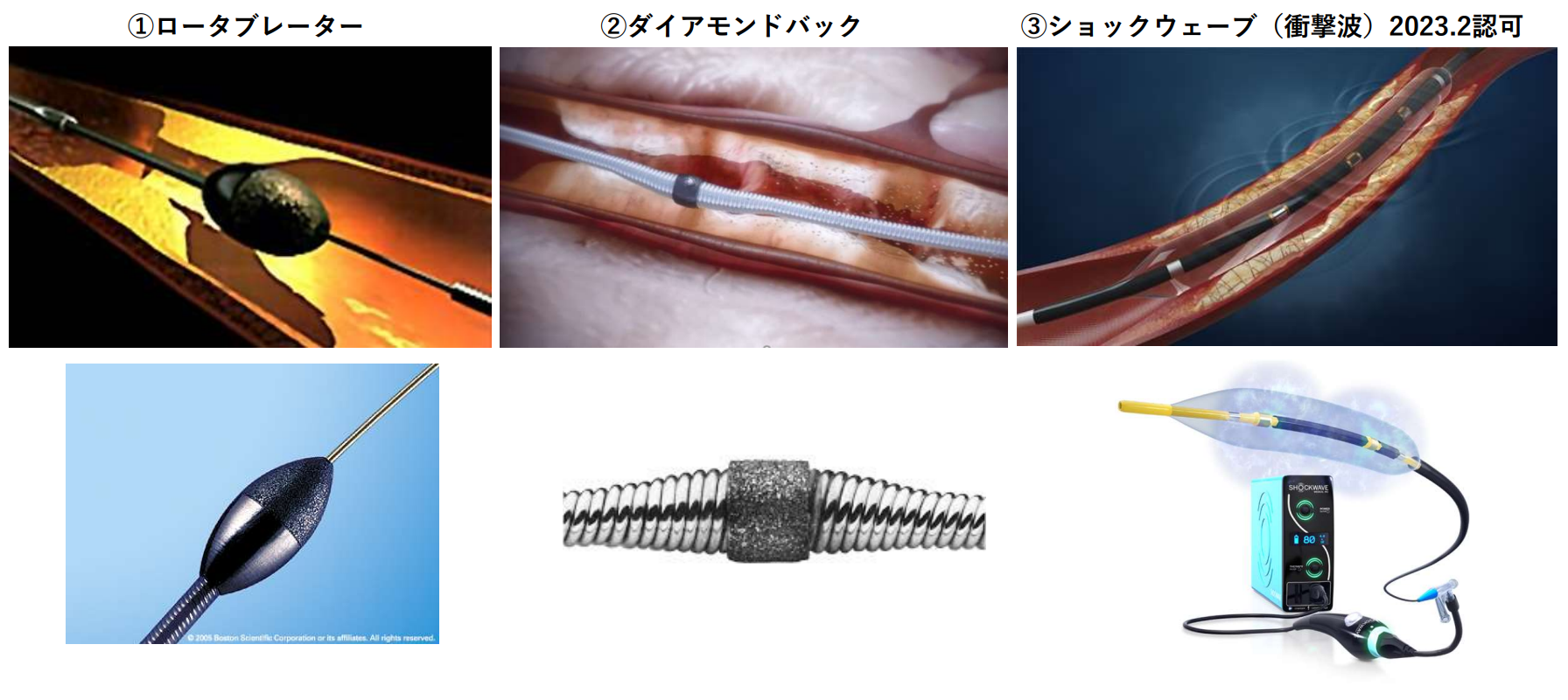 ①ローターブレーター、②ダイアモンドバック、③ショックウェーブ の写真