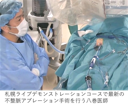 札幌ライブデモンストレーションコースで最新の不整脈アブレーション手術を行う八巻医師